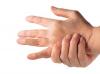 Rheumatoid Arthritis of the Hand 