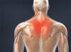 Muscle Strain of the Upper Back 