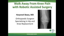 Dr. Harpreet Bawa - Walk Away From Knee Pain with Robotic Assisted Surgery